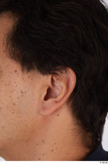 Photos of Cristian Andrade ear 0001.jpg